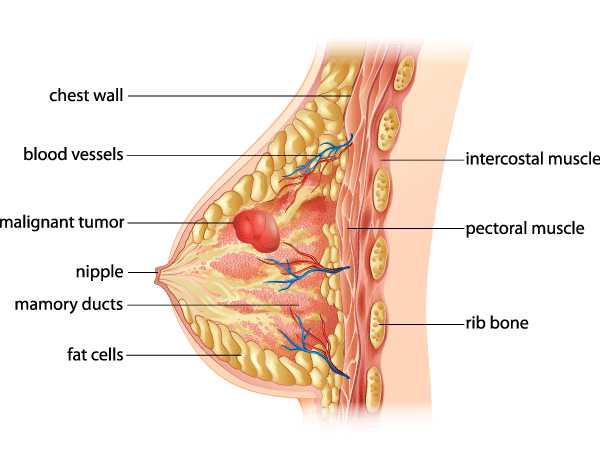 Representative breasts.  Download Scientific Diagram